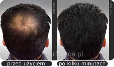 HairFor2 efekt