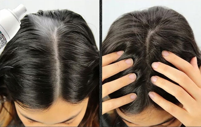 Sevich Rice Water Hair Growth Spray 50ml 