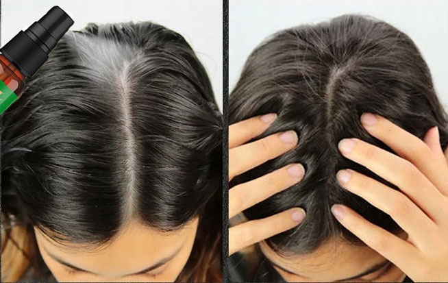 Sevich Rosemary Hair Serum 30ml